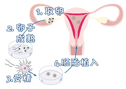 借卵代孕哪里做的最好生殖医学中心